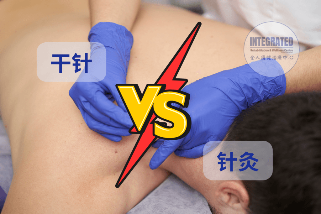 干针与针灸的对比示意图，展示两种技术在肩颈区域的操作方式与临床应用差异。